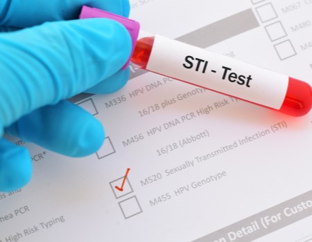 STD testing & treatment